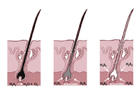 Nguyên nhân khiến tóc bạc sớm và cách chữa trị  Nhà thuốc FPT Long Châu