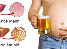 Cách giải rượu bia giải độc gan